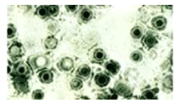 単純ヘルペスウイルス