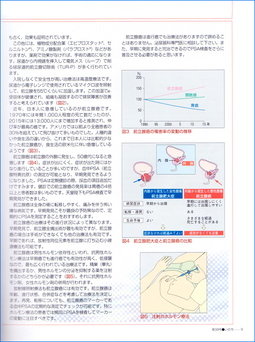 前立腺肥大症・前立腺癌2