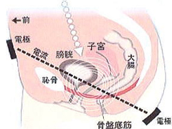 骨盤底筋